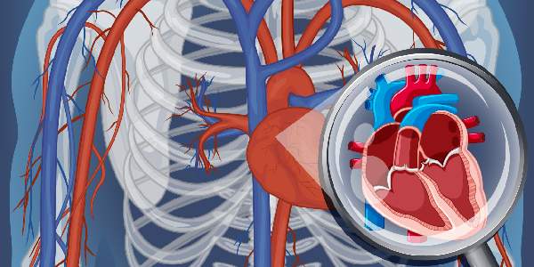 Angioplasty-Pacemaker